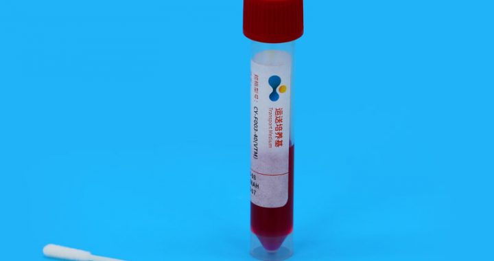 Viral Transport Medium Sample Collection Tube